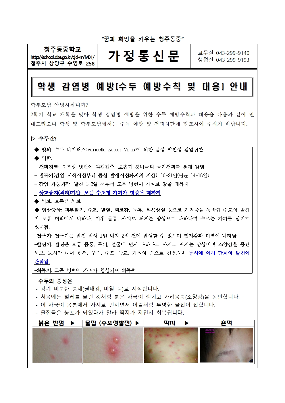 학생 감염병 예방(수두 예방수칙 및 대응)안내001