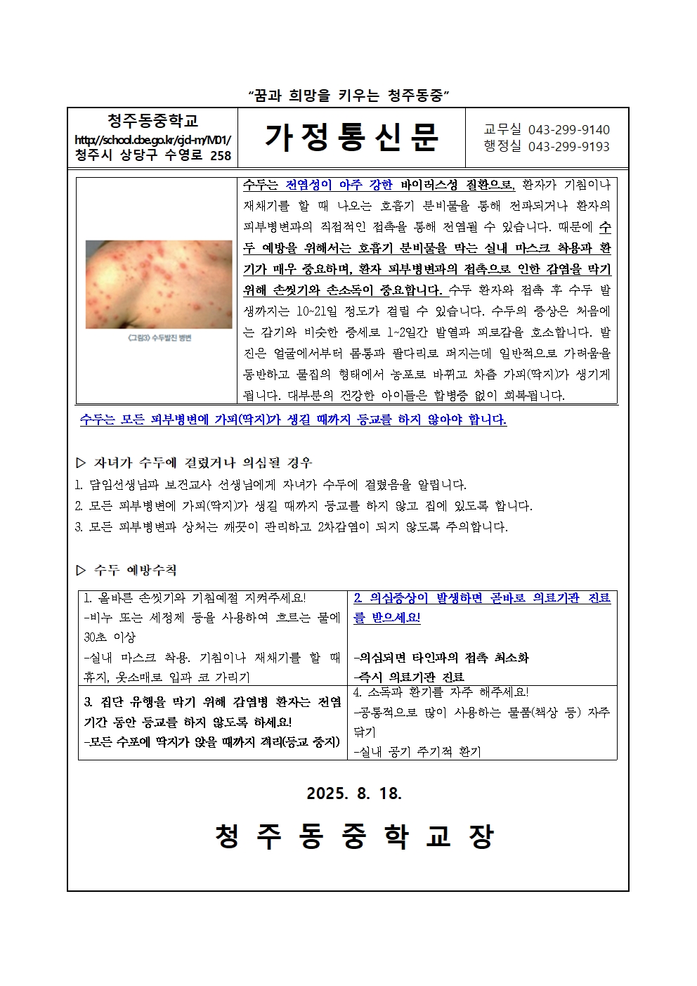 학생 감염병 예방(수두 예방수칙 및 대응)안내002